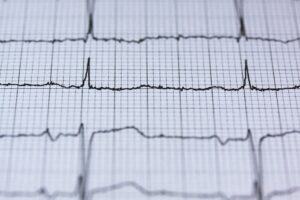 Hidden Heart Attack
